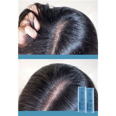 Шампунь-бальзам против перхоти 2 в 1 Expert Hair Advanced Care